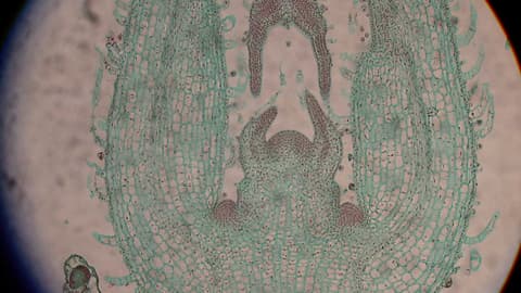 The longitudinal section of the tip of an onion root under microscope